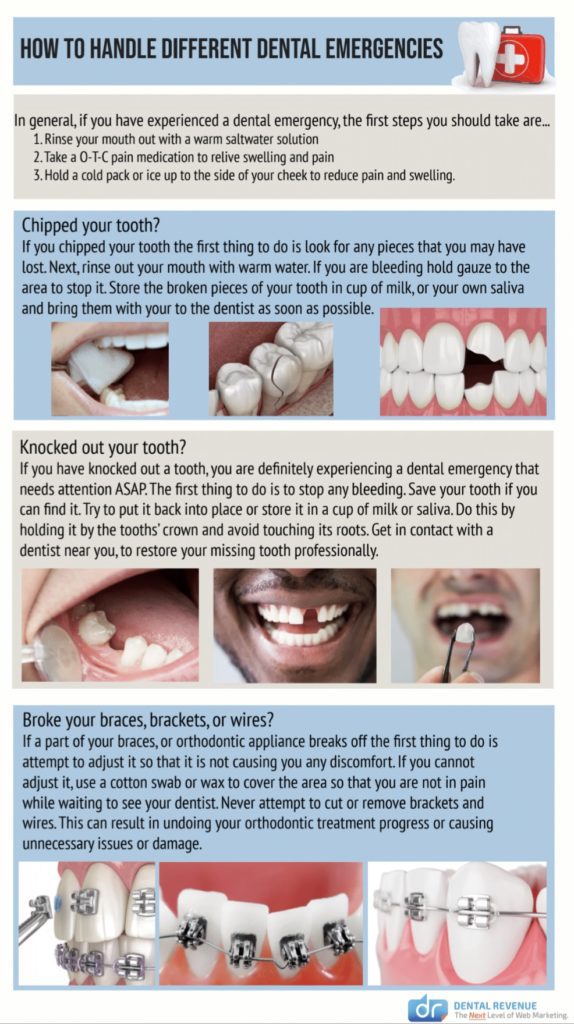 How to Handle Dental Emergencies Infographic