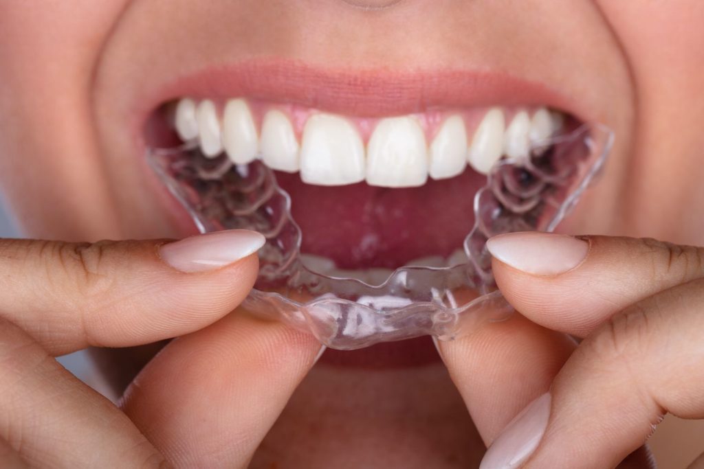 Invisalign aftercare Indianapolis Indiana