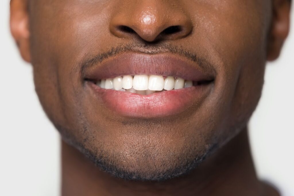 Does Teeth Whitening Treatment Hurt